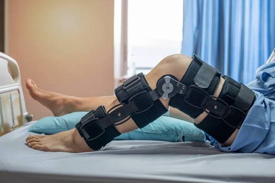 ACL Surgery Recovery