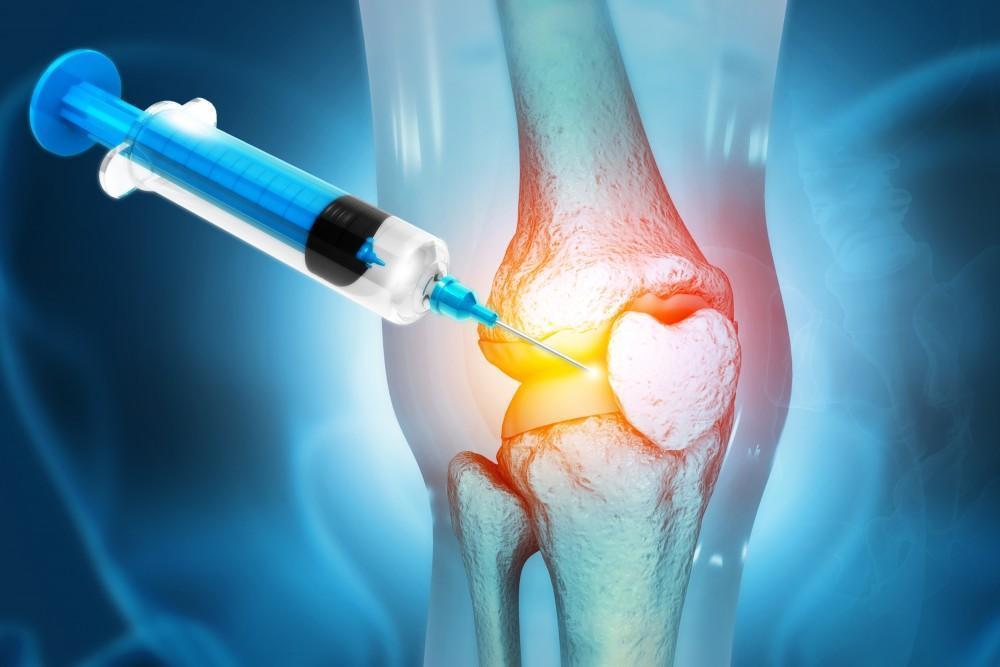 PRP Injection Knee Pain