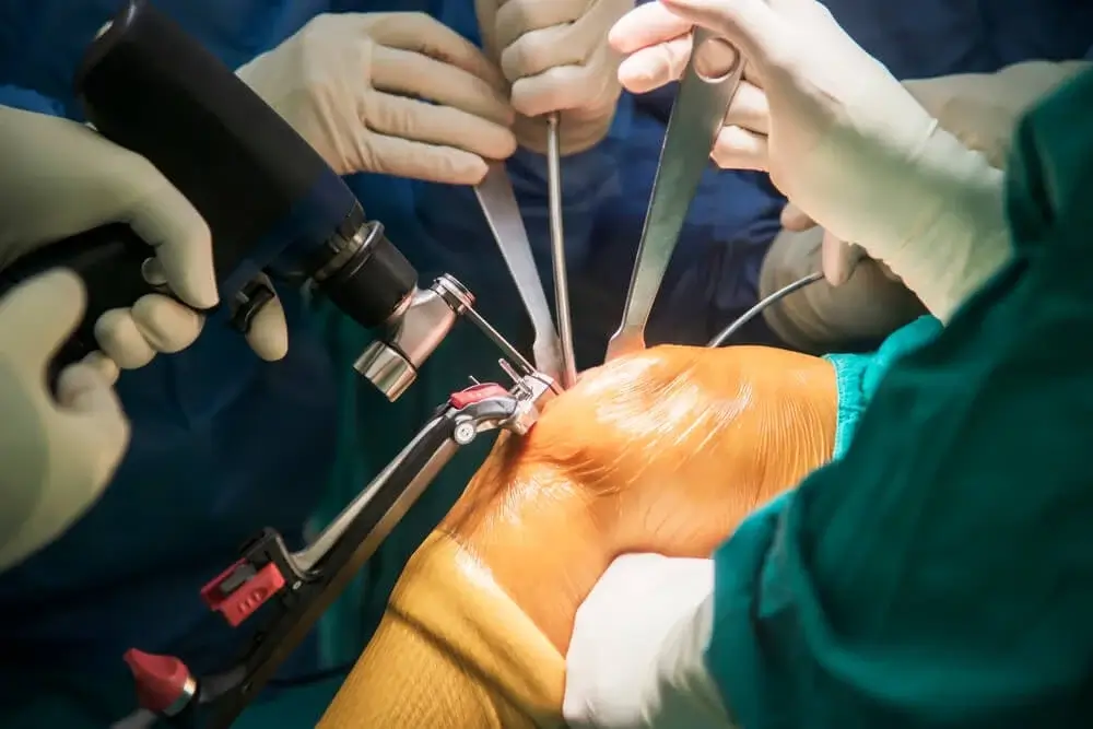 Joint Replacement